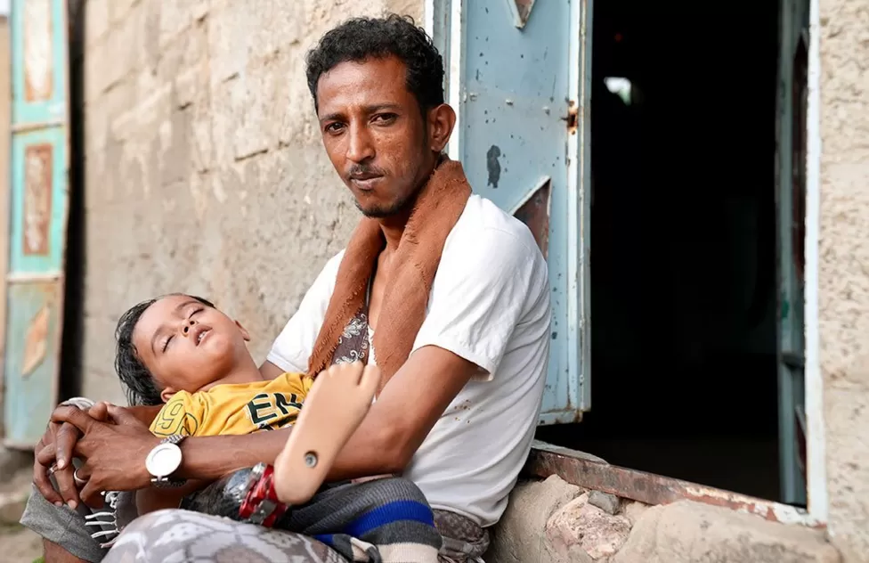 Amir remembers every moment after the shelling that took his leg