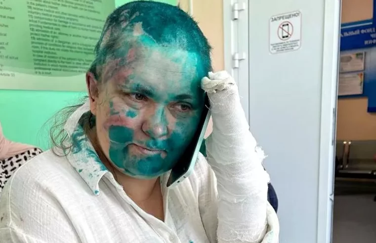 Chechnya Milashina attack: Armed thugs beat up Russian journalist and lawyer