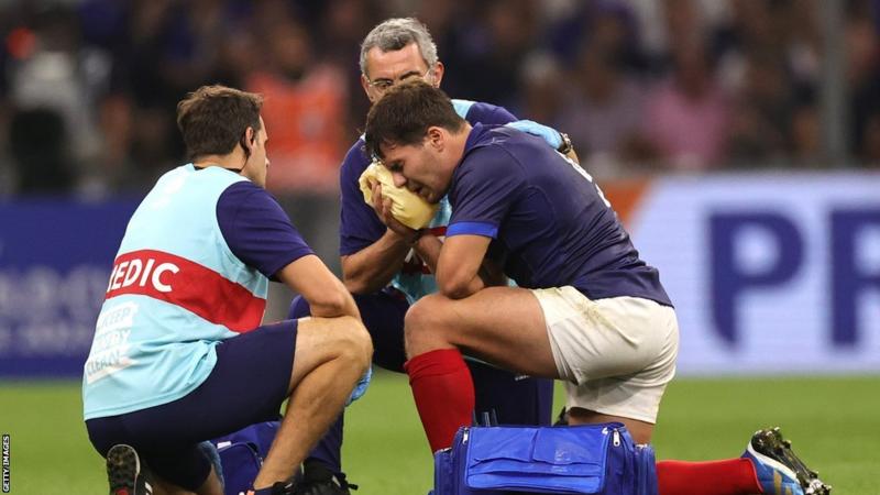 France captain suffers fractured cheekbone in Rugby World Cup