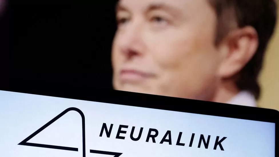 Musk start-up Neuralink seeks people for brain-implant trial