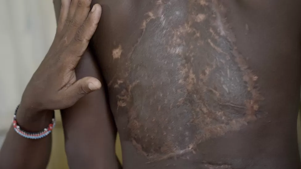 The children suffering from a hidden epidemic
